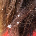 Snowflakes in my hair, Switzerland